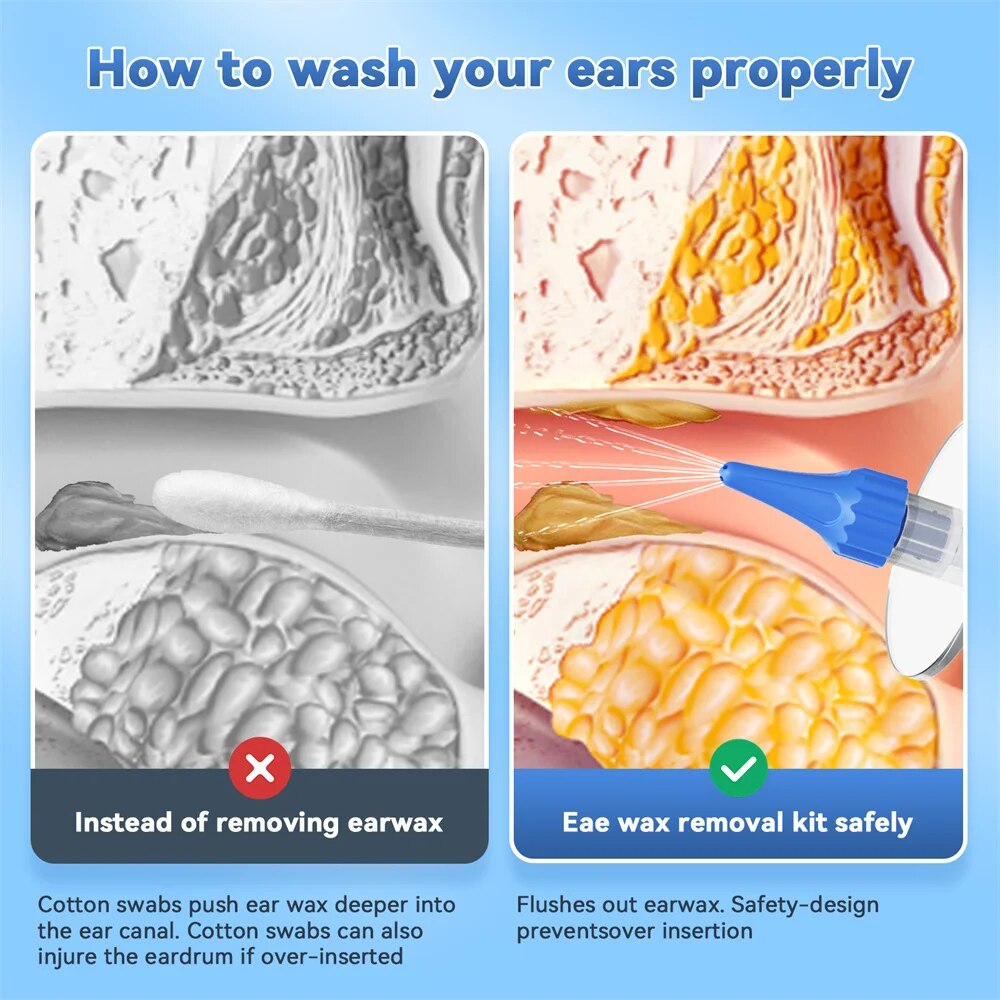 Ear Wax Removal Manual Ear Cle - Urban Farming System ulasan dan harga
