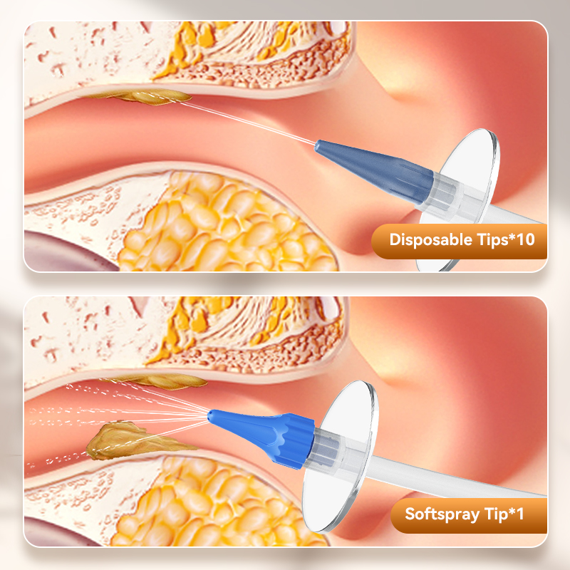 Ear Wax Removal Manual Ear Irr - Urban Farming System ulasan dan harga